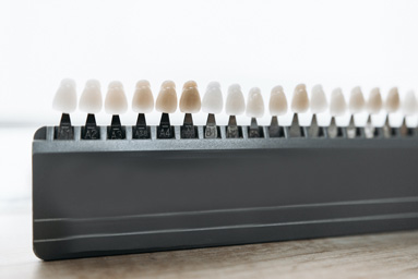 A variety of sizes of colors and sizes of dental veneers on display