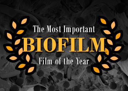 Seattle dentist, Dr. Dan McKay of McKay Center for Cosmetic & General Dentistry, explains what biofilm is and the role it plays in your oral health and overall wellness.
