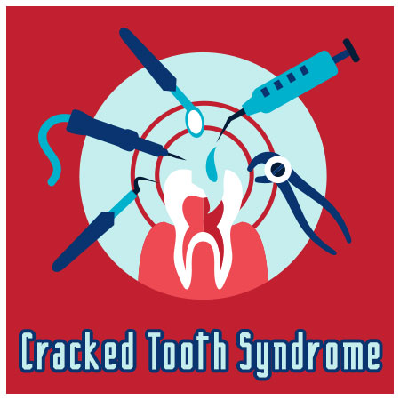 Seattle dentist, Dr. Daniel McKay at Mckay Center for Cosmetic and General Dentistry, discusses causes, symptoms, and treatment of cracked tooth syndrome.
