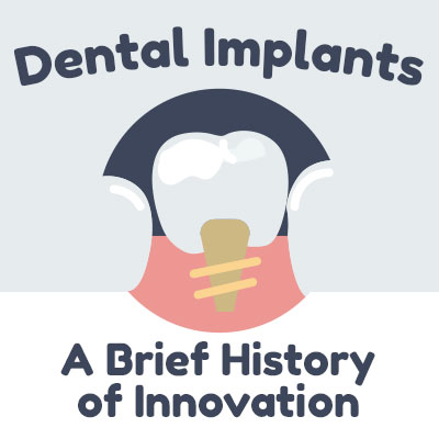 Seattle dentist, Dr. Dan McKay of McKay Center for Cosmetic & General Dentistry discusses dental implants and shares some information about their history.