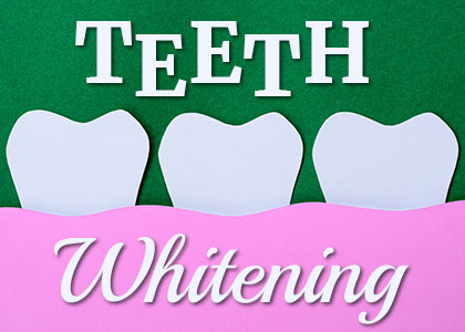 Seattle dentist, Dr. Dan McKay at McKay Center for Cosmetic and General Dentistry shares everything you need to know about different types of teeth whitening.